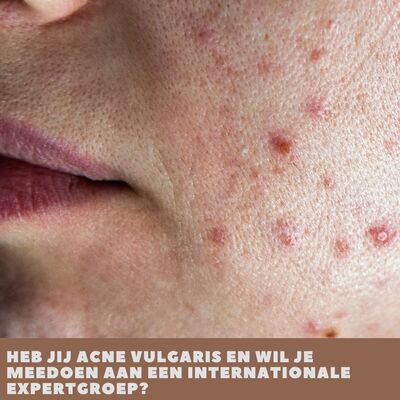 oproep expertgroep acne vulgaris