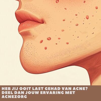 HEB JIJ OOIT LAST GEHAD VAN ACNE? DEEL DAN JOUW ERVARING MET ACNEZORG