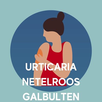Urticaria informatiepagina urticaria - netelroos - galbulten